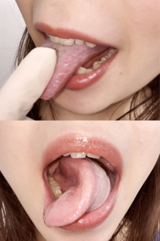 口腔内トラブル多し...【歯ぎしりでギザギザ歯?!】SAX奏者のミモリンの舌使いは、尺八も唸らせてしまう程のテクニック♥