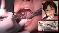 フェチ：虫歯治療行きは納得の西村有紗さん‼重度の虫歯で銀歯確定...【治療1日目】