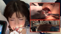 フェチ：【西村有紗の虫歯治療2・3日目】銀歯2連装填！出血大ボリューム治療‼