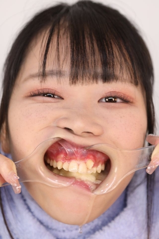 【I-cup美女の切なる悩み】チャームポイントの八重歯が…生え変わる事の無い乳歯に合わせて９本抜歯予定！　愛瀬ゆうり