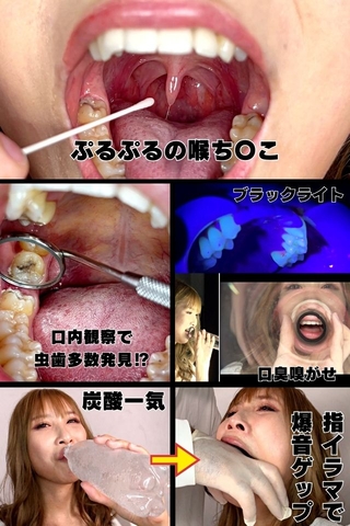 【歯医者案件】ビューティーLady 松野蘭に即歯医者連行の大虫歯発見⁉～卑猥にくねるベロ接吻、そして爆音ゲップ！