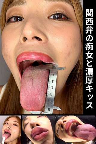 【歯医者案件】ガチでヤバい歯⁉関西『歯』ガールズコレクションでぶっちぎり優勝のGAL口内