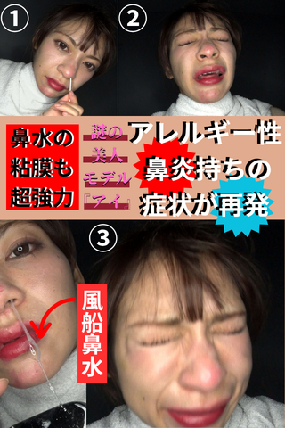 注射治療を施す程の重度な鼻炎持ちのクランケにBBM軍団はどう立ち向かう!?【鼻水風船の粘度は異常の表れ??】クシャ顔◎
