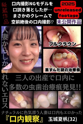 多数の治療痕＆フルクラウンみ～っけ！リアル人妻 夏帆さんのエロすぎた口内【2025年未公開作品vol.2】
