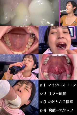 多数の治療痕＆フルクラウンみ～っけ！リアル人妻 夏帆さんのエロすぎた口内【2025年未公開作品vol.2】