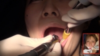フェチ：【虫歯治療】口内観察で虫歯発見⁉診察で予想以上の虫歯の深さに絶句！麻酔で失神寸前‼