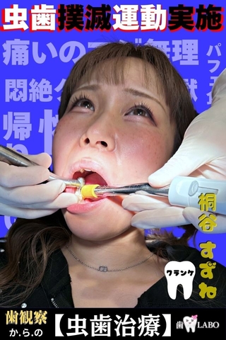 【虫歯治療】口内観察で虫歯発見⁉診察で予想以上の虫歯の深さに絶句！麻酔で失神寸前‼