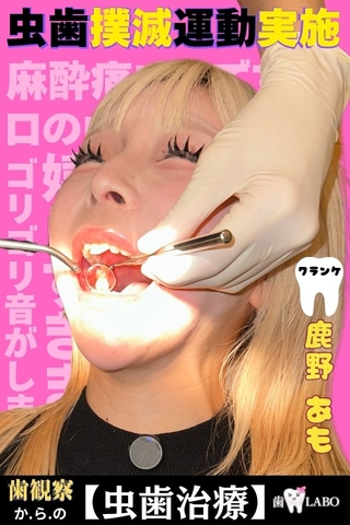 【虫歯治療】天然歯に刻まれた黒印‼ゆるふわましゅまろボディGAL鹿野あもちゃんの初虫歯治療