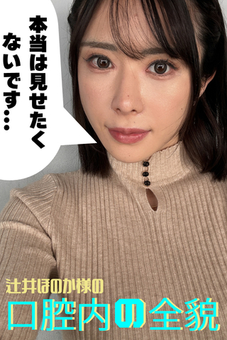 【辻井ほのか様の口腔内の全貌】歯科治療撮影決定?!